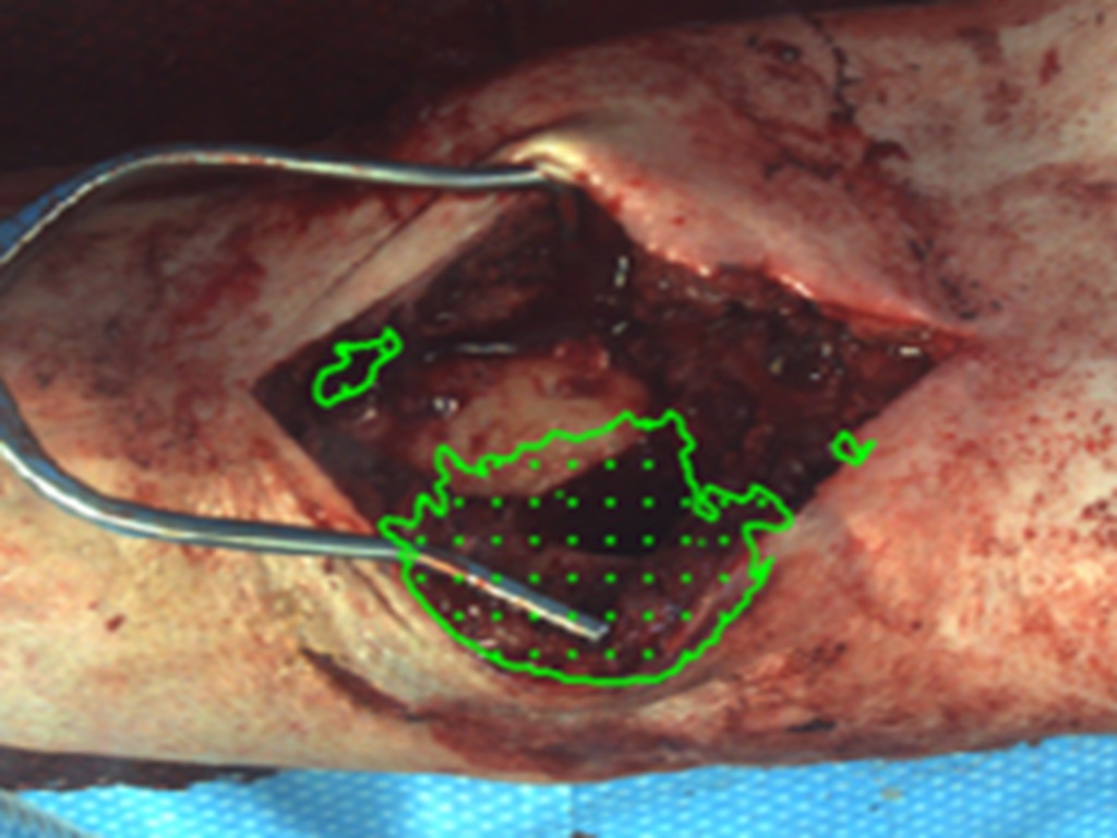 Fluorescence-Guided Imaging